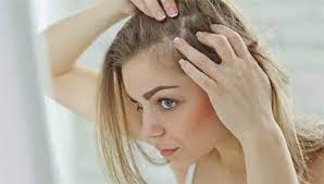 Si cette perte de cheveux dure moins de 6 mois on parle d 'une perte de cheveux aiguë. Calvitie Femme Perte De Cheveux Clinique Duquesne