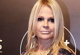 Médico diz que nádegas de Michael Jackson estavam detondas por injeções