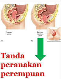 Jamu Bonda 11 Simptom Rahim Jatuh 1 Sakit Ari Ari Facebook