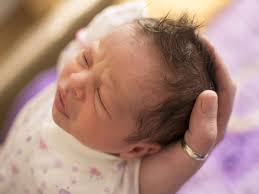 Babies, especially premature babies and those with medical problems, may use a washcloth to wash his or her face and hair. Do Newborn Babies Suffer From Hair Loss Boldsky Com
