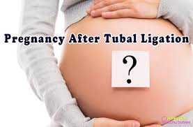 Parentingbabies On Twitter 7 Signs And Symptoms Of Pregnancy After Tubal Ligation Https T Co 80cdknkgjx Howcommonispregnancyaftertuballigation Pregnancyaftertuballigationstatistics Pregnantaftertuballigationstories