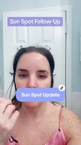 Trenton Owen Before and After Pictures