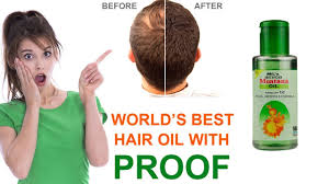 Arnica hair oil is considered to be one of the best remedies for reversing hair loss and promoting fast and healthy hair growth. Arnica Montana Hair Oil Benefits Arnica Montana Hair Oil Effect Arnica Montana Oil And Shampoo Youtube