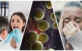 A group a streptococcal infection is an infection with group a streptococcus (gas). Streptococ Betahemolitic Grup A Divahair Ro