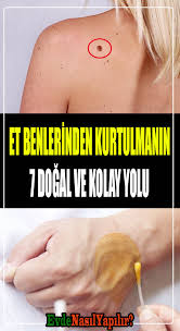 Et Benlerinden Kurtulmanin 7 Kolay Ve Dogal Yolu Et Beni Dusurme Yontemleri Et Benlerini Patir Patir Doken Tarif Dogal Dogal Saglik Dogal Cilt Bakimi