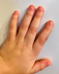 If this article on how to stop biting nails in 9 minutes helped or inspired you to stop, please let us know in the comments. Art Of Prevention The Importance Of Tackling The Nail Biting Habit Sciencedirect