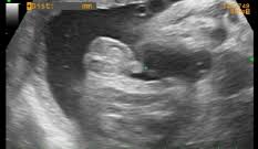 Semana 30 De Embarazo Inatal El Embarazo Semana A Semana