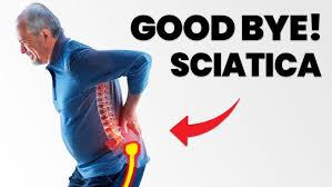 Image result for Sciatica