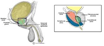 Prostate Cancer Clinical Features Screening Teachmesurgery