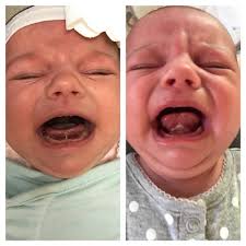 See full list on mayoclinic.org Can You Tell A Tongue Lip Tie From Pics W Pictures Mattos Lactation