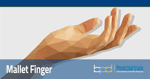 Mallet joint is an injury to the distal interphalangeal, or dip, joint of the finger. Mallet Finger Brandon P Donnelly Md