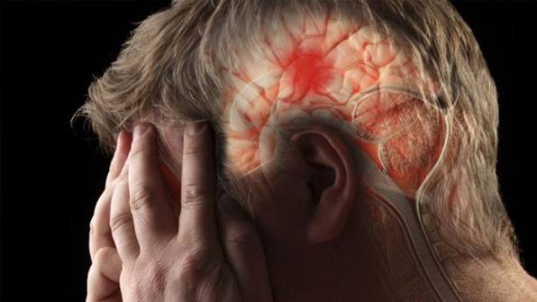 سکته مغزی خفیف خطرناک است؟