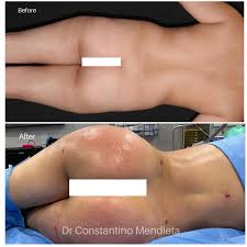 Mendieta has trained in aesthetic surgery at harvard, had advanced plastic surgery training at the royal college of surgeons in england and then . 4 Beauty Aesthetics Institute Inc Constantino G Mendieta Md Facs Home Facebook