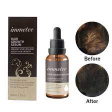 However, we do not sometimes have healthy hair. China High Quality Protein Hair Repair Oil Olive Hair Care Oil For Hair Regrowth China Hair Growth Oil And Hair Growth Products Price