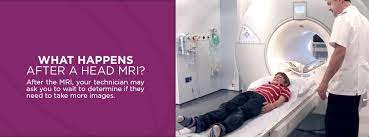An mri typically takes between 30 and 60 minutes. What To Expect In An Mri For The Head And The Brain Envision Radiology