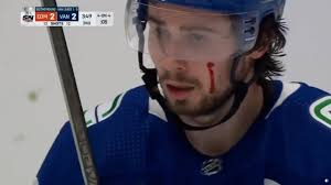 Canucks 2024 Playoff Thread