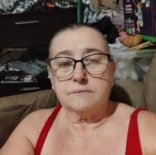 Dose any one else come up like these red bruises for no reason n feel like  your whole body is burning xx