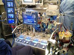Citation machine® helps students and professionals properly credit the information that they use. Cardiopulmonary Bypass Sciencedirect