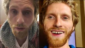 My 1 Week Sananga Experience! Eye medicine?