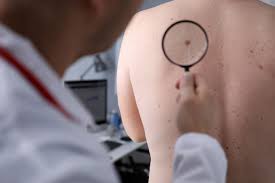 Patients who know what to look for and regularly screen their skin for cancers, are much more likely to receive a diagnosis in early, more treatable stages.&quot; What Does Early Skin Cancer Look Like