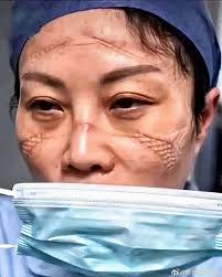 Dr. Olivier Meyer updated their status.