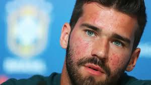 Rosácea: entenda a doença revelada pelo goleiro Alisson Becker