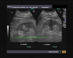 Ultrasound Image Gallery Diagnostic Medical Sonography Ultrasound Sonography