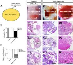 The Impact Of High Salt Exposure On Cardiovascular