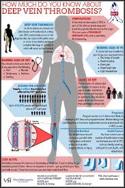 Deep Vein Thrombosis Vein Specialists Of Illinois