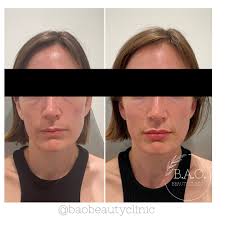 B.A.O. Beauty Clinic