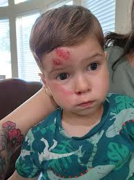 Rowe Casa hair spritz for hair growth