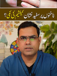 Nakhunon Par Safed Nishan Calcium Ki Kami? White spots