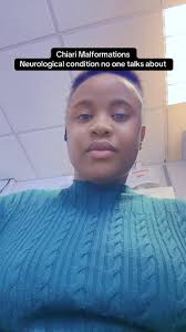 Chiari malformations (often misspelled as “Charia”) are structural defects  in the brain and spinal cord, specifically involving the part of the brain  called the cerebellum. They occur when brain ...