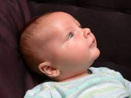 How To Treat Your Infant S Allergies Teaching Babies Newborn Acne Baby Health