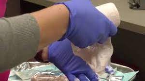 Wound Care Mercy Medical Center Redding Dignity Health
