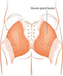69: Syndrome Du Muscle Grand Fessier | Medicine Key