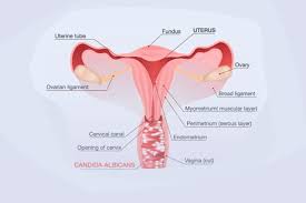 Image result for Vaginitis