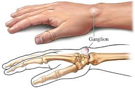 Pin On Top Health Topics Bone Joint Muscles