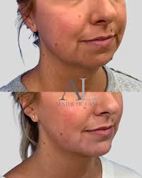 Your April specials are here ✨ Curated by Brittany and Jane to support your  skin goals. Book your next appointment: 📞 (407) 601-0753 ✨ Schedule in the  link in our bio