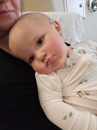 POD 8: Still inpatient as she continues to require oxygen while sleeping.  Her labs from yesterday came back okay, and she hasn't had another fever.  As of now, they are continuing to