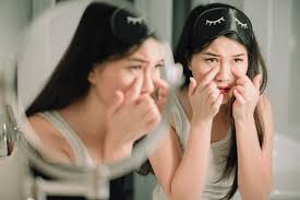 Kalau kamu juga punya jenis kulit kering berjerawat, yuk langsung simak videonya! Fd Little Notes Semua Tentang Kulit Kering