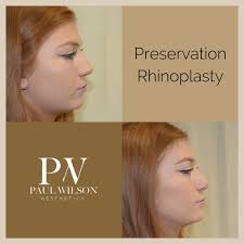 Paul Wilson Cosmetic Surgeon