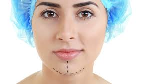 Dimpleplasty Surgically Makes Dimples