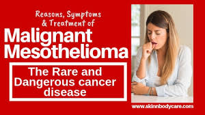 If you or someone you know has been diagnosed with mesothelioma, you may be entitled to financial compensation. Mesothelioma Causes Symptoms Diagnosis Treatment And Life Expectancy Ias Exam Guide