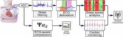 Online Obstructive Sleep Apnea Detection On Wearable Sensors Esl Epfl