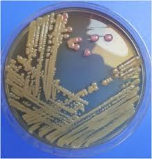 May 27, 2021 · ワクチン接種者の母乳中の抗体 3ヶ月前; Clinical Manifestation And Outcomes Of Multi Drug Resistant Mdr Raoultella Terrigena Infection A Case Series At Indus Health Network Karachi Pakistan Sciencedirect