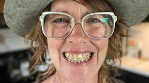 Fundraiser by Jennifer Markey : Jen Markey's Braces and Help With Surgery  Recovery