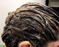 Pcos hair loss follows the pattern of hair loss as seen in males. Stop And Reverse Pcos Hair Loss Visihow