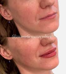 Cydney Brown BSN, RN (@cosmeticnursecydney) • Instagram photos and videos