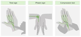 Image result for Carpal Compression Test